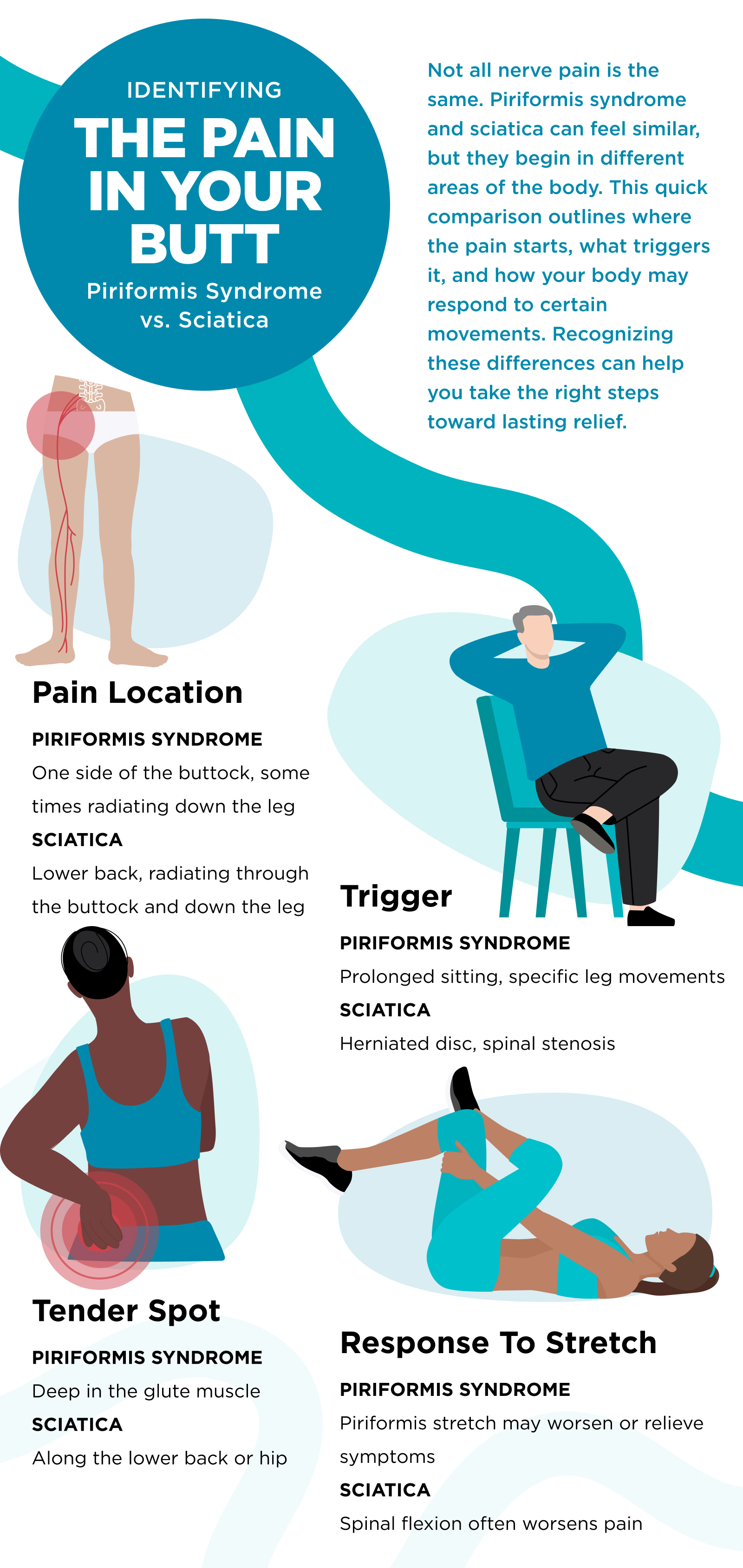 Identifying The Pain In Your Butt: Piriformis Syndrome vs. Sciatica